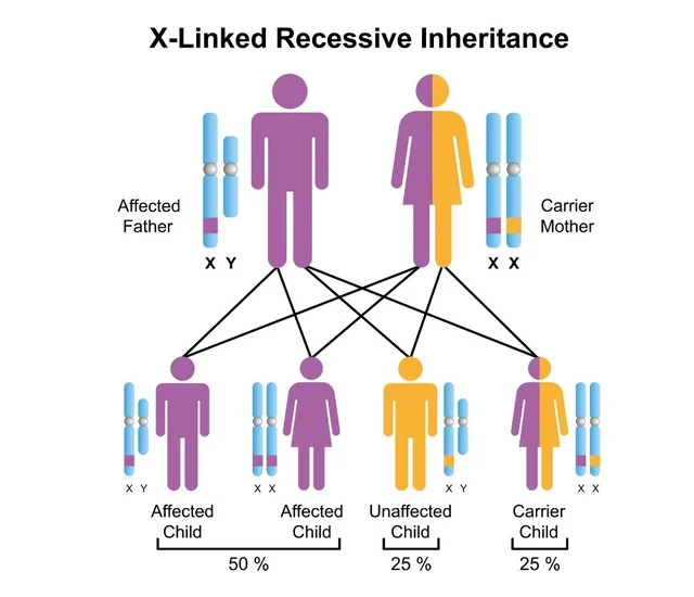 X-Linked Recessive Inheritance diagram showing affected father, carrier mother, and affected/unaffec.