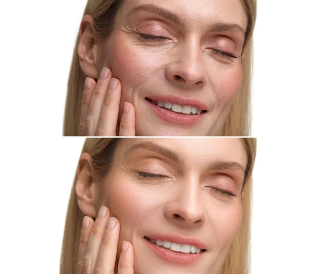 A woman with clear, smooth skin gently touching her cheek, smiling with eyes closed.
