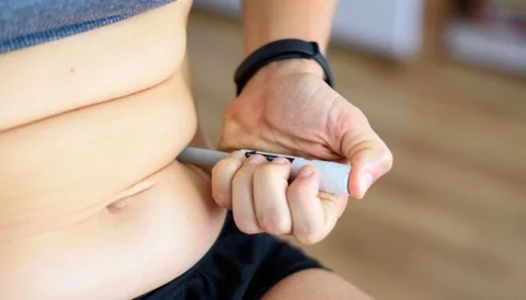 Liposuction procedure being performed on a patient's abdomen with a small cannula.