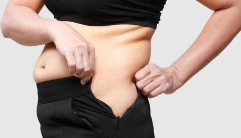 Liposuction procedure showing a woman pinching fat on her abdomen.