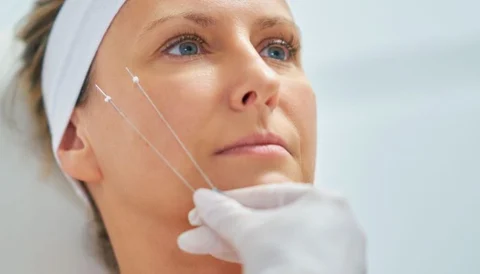 A woman receiving a facial treatment with two fine needles near her cheek.