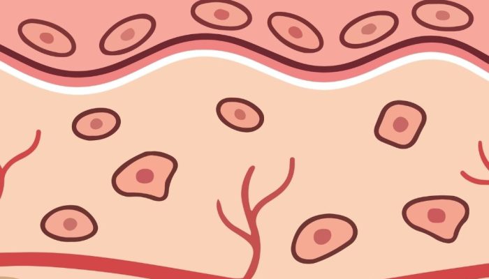 A diagram showing skin layers and facial tissue structure for volume and support.